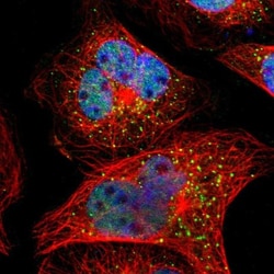 SMARCD1 Antibody, Novus Biologicals:Antibodies:Primary Antibodies